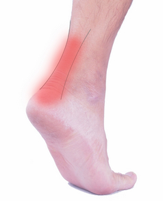 Achilles Tendonitis